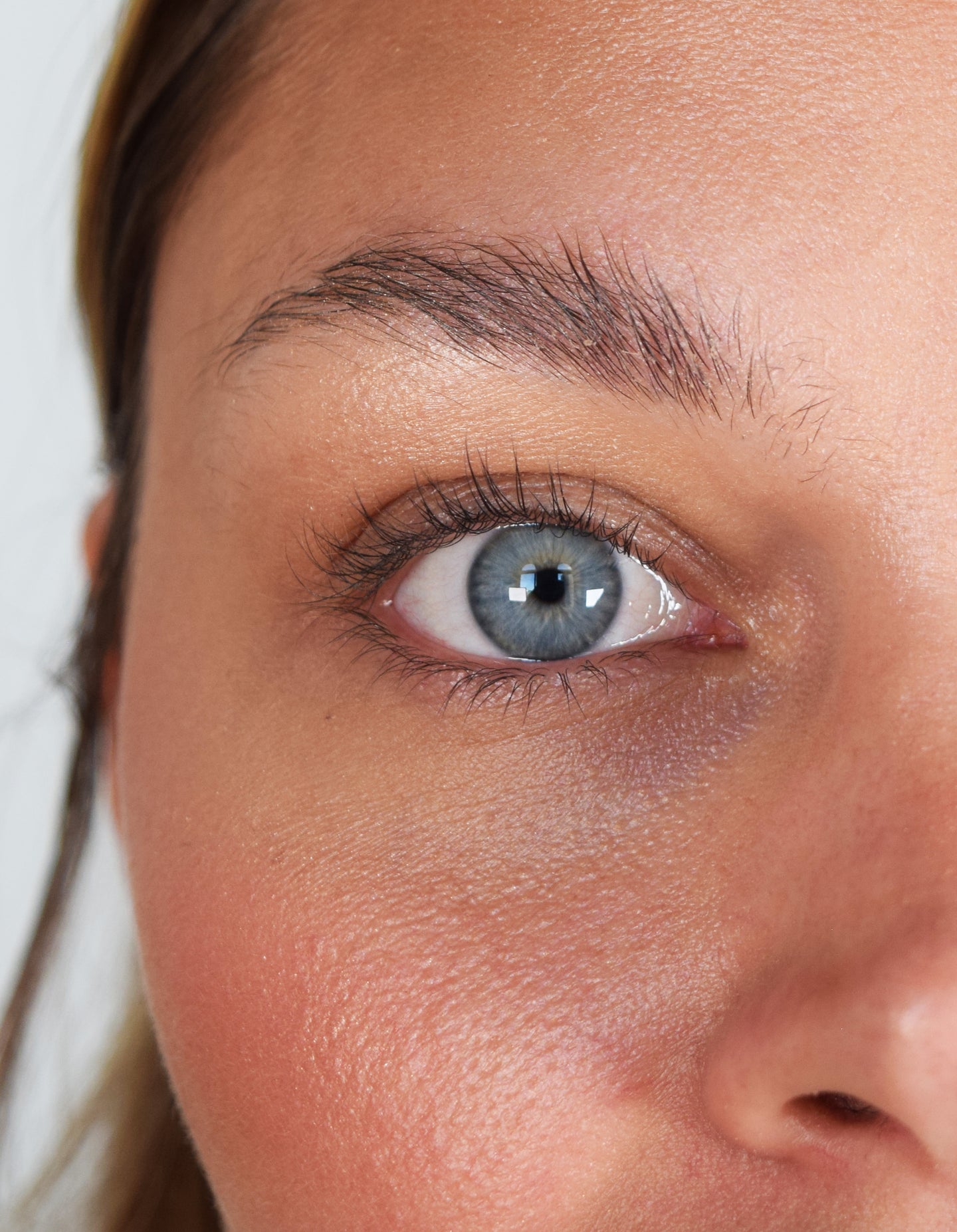 Após 28 dias com XLASH