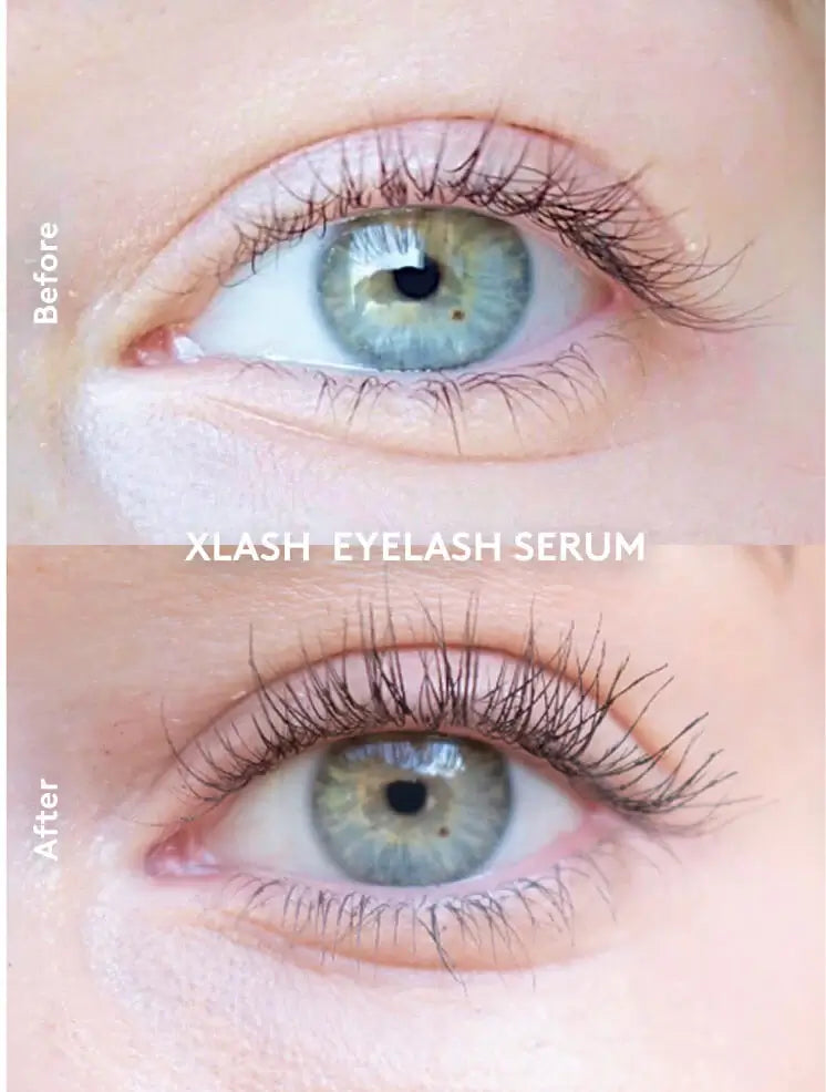 Xlash sérum crescimento pestanas mais longas