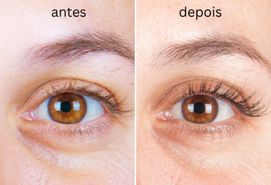 resultados sérum de pestanas sensível