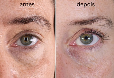 Xlash Sensitive Heroes Kit