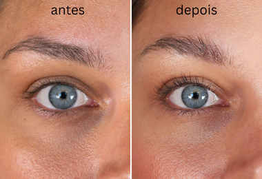 Kit para cuidados com olhos sensíveis Xlash