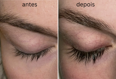 kit para olhos sensíveis