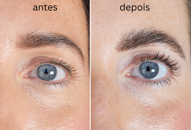 crescimento de pestanas e sobrancelhas